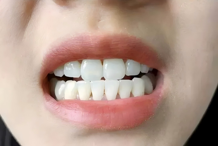 �ڱ��õ�ȥ������������ôѡ����ǻ��ר�Ҵӳɷ֡��ڱ���������Ⱥһ�ν���