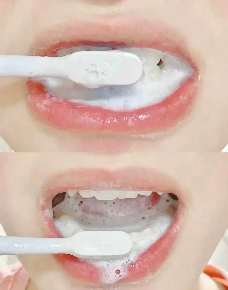 口臭反复、口干口苦怎么选？信誉好的丘安口腔抑菌膏选购与使用答疑